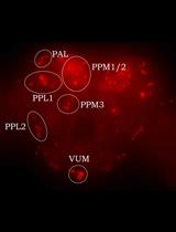 A Simple Immunofluorescence Method to Characterize Neurodegeneration and Tyrosine Hydroxylase Reduction in Whole Brain of a Drosophila Model of Parkinson’s Disease