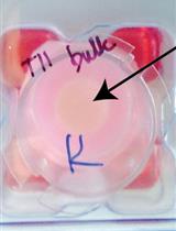 用于信号通路研究的磷酸化蛋白质组分析和器官型培养