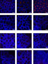 Real-Time Autophagic Flux Measurements in Live Cells Using a Novel Fluorescent Marker DAPRed