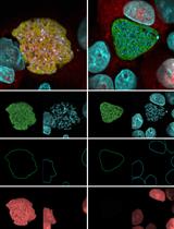 用于宿主和寄生虫新生蛋白质组同时定量生物成像的优化伯氏疟原虫肝期- HepG2感染模型
