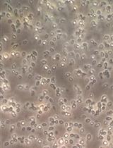 通过离子交换色谱、凝胶过滤和MDPF-明胶-酶谱分析法准备和纯化β-1,3-葡聚糖连接的光滑念珠菌细胞壁蛋白酶