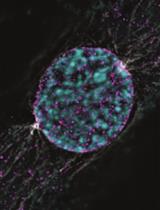 Dissecting the Mechanical Control of Mitotic Entry Using a Cell Confinement Setup