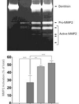 Purification of Native Dentilisin Complex from <em>Treponema denticola</em> by Preparative Continuous Polyacrylamide Gel Electrophoresis and Functional Analysis by Gelatin Zymography