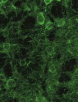 Imaging Single-Cell Ca2+ Dynamics of Brainstem Neurons and Glia in Freely Behaving Mice