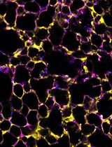 A Novel Method for Floxed Gene Manipulation Using TAT-Cre Recombinase in Ex Vivo Precision-Cut Lung Slices (PCLS)