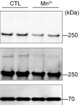 Apolipoprotein B Secretion Assay from Primary Hepatocytes