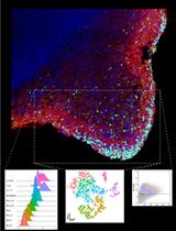 Generation of Skeletal Muscle Organoids from Human Pluripotent Stem Cells