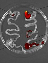 Fluorescent Labeling and Imaging of IL-22 mRNA-Loaded Lipid Nanoparticles