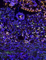 A Detailed Protocol for the Induction of Anemia and RBC Transfusion–associated Necrotizing Enterocolitis in Neonatal Mice