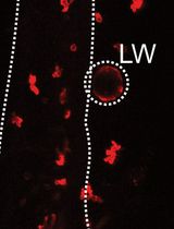 Visualising Neutrophil Actin Dynamics in Zebrafish in Response to Laser Wounding Using Two-Photon Microscopy