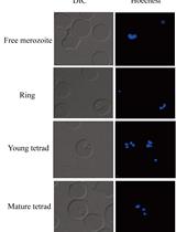 邓氏巴贝斯虫基因转染：推进巴贝斯虫生物学的遗传工具箱