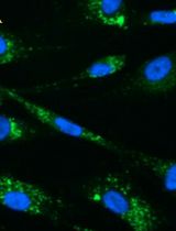 Quantification of Autophagosomes in Human Fibroblasts Using Cyto-ID<sup>®</sup> Staining and Cytation Imaging