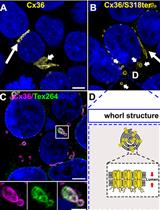 Characterizing ER Retention Defects of PDZ Binding Deficient Cx36 Mutants Using Confocal Microscopy