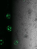 Analysis of Guard Cell Readouts Using Arabidopsis thaliana Isolated Epidermal Peels