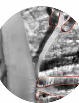 Approach for Electrophysiological Studies of Spinal Lamina X Neurons