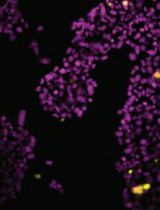 Well Plate–Based Localized Electroporation Workflow for Rapid Optimization of Intracellular Delivery