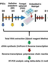 Generation of Multicellular 3D Liver Organoids From Induced Pluripotent Stem Cells as a Tool for Modelling Liver Diseases