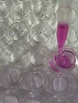 An Experimental Protocol for the Boyden Chamber Invasion Assay With Absorbance Readout