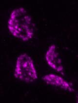 Expansion Microscopy of Synaptic Contacts on the Mauthner Cells of Larval Zebrafish