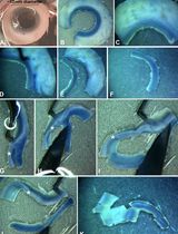 符合GMP标准的角膜基质干细胞培养全流程