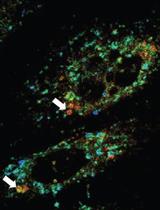 Fluorescence Lifetime-Assisted Probing of Protein Aggregation with sub-Organellar Resolution