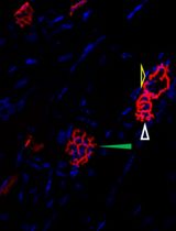 Visualization and Analysis of Neuromuscular Junctions Using Immunofluorescence