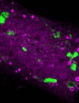 Acutely Modifying Phosphatidylinositol Phosphates on Endolysosomes Using Chemically Inducible Dimerization Systems