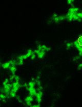 Chromogranin B Purification for Condensate Formation and Client Partitioning Assays In Vitro