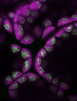 Fluorescent Staining and Quantification of Starch Granules in Chloroplasts of Live Plant Cells Using Fluorescein