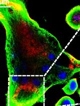 An In Vitro Model of Murine Osteoclast-Mediated Bone Resorption