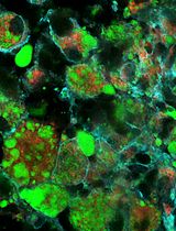 Assessment and Quantification of Foam Cells and Lipid Droplet–Accumulating Microglia in Mouse Brain Tissue Using BODIPY Staining