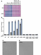 96孔板NF-κB/AP-1报告基因检测转染细胞中野生型及致病性ALPK1突变体活性