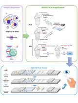 Development of a Rapid Epstein–Barr Virus Detection System Based on Recombinase Polymerase Amplification and a Lateral Flow Assay