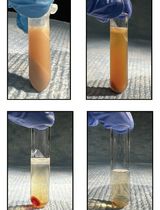 Assessment of SREBP Activation Using a Microsomal Vesicle Budding Assay