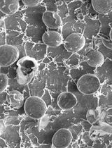 Cryo-SEM Investigation of <em>Chlorella</em> Using Filter Paper as Substrate