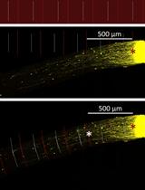 Optic Nerve Crush in Mice to Study Retinal Ganglion Cell Survival and Regeneration