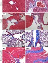 Analysis of Generalized Fibrosis in Mouse Tissue Sections with Masson’s Trichrome Staining