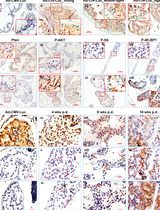 Temporally and Spatially Controlled Age-Related Prostate Cancer Model in Mice