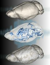 Automatic Adaptive Algorithm for Delineation of Cerebral-Spinal Fluid Regions for Non-contrast Magnetic Resonance Imaging Volumetry and Cisternography in Mice