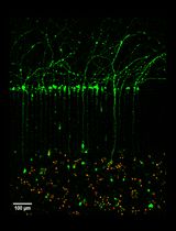 用于活细胞成像评估逆行性细胞死亡的基底前脑胆碱能神经元微流体培养