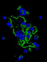 In Vitro Assay to Examine Osteoclast Resorptive Activity Under Estrogen Withdrawal