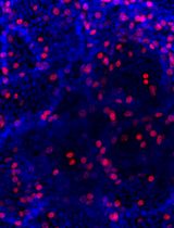 An Optimized Protocol for Simultaneous Propagation of Patient-derived Organoids and Matching CAFs