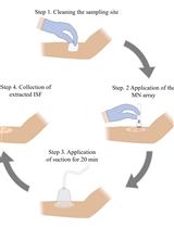 Rapid Sampling of Large Quantities of Interstitial Fluid from Human Skin Using Microneedles and a Vacuum-assisted Skin Patch