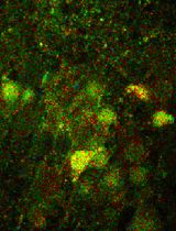 Quantitative, Dynamic Detection of Neuronal Na<sup>+</sup> Transients Using Multi-photon Excitation and Fluorescence Lifetime Imaging (FLIM) in Acute Mouse Brain Slices