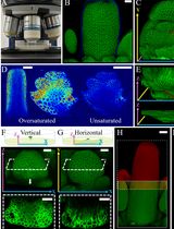 Confocal Live Imaging of Reproductive Organs Development in Arabidopsis