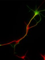 Primary Neuronal Culture and Transient Transfection