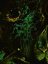 Combined FLIM, Confocal Microscopy, and STED Nanoscopy for Live-Cell Imaging