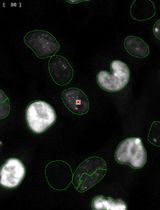 Streamlined Quantification of p-&gamma;-H2AX Foci for DNA Damage Analysis in Melanoma and Melanocyte Co-cultures Exposed to FLASH Irradiation Using Automated Image Cytometry