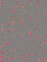 Real-time IncuCyte<sup>&#174;</sup> Assay for the Dynamic Assessment of Live and Dead Cells in 2D Cultures