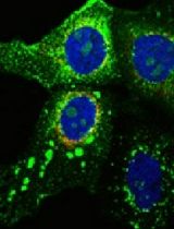 Development and Application of MLB Human Astrovirus Reverse Genetics Clones and Replicons